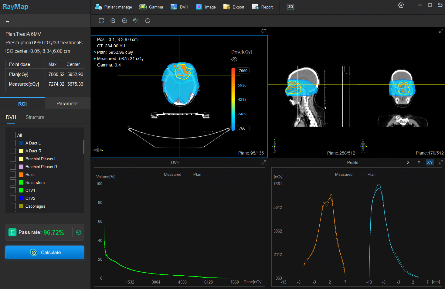 RayMap 智能全流程
