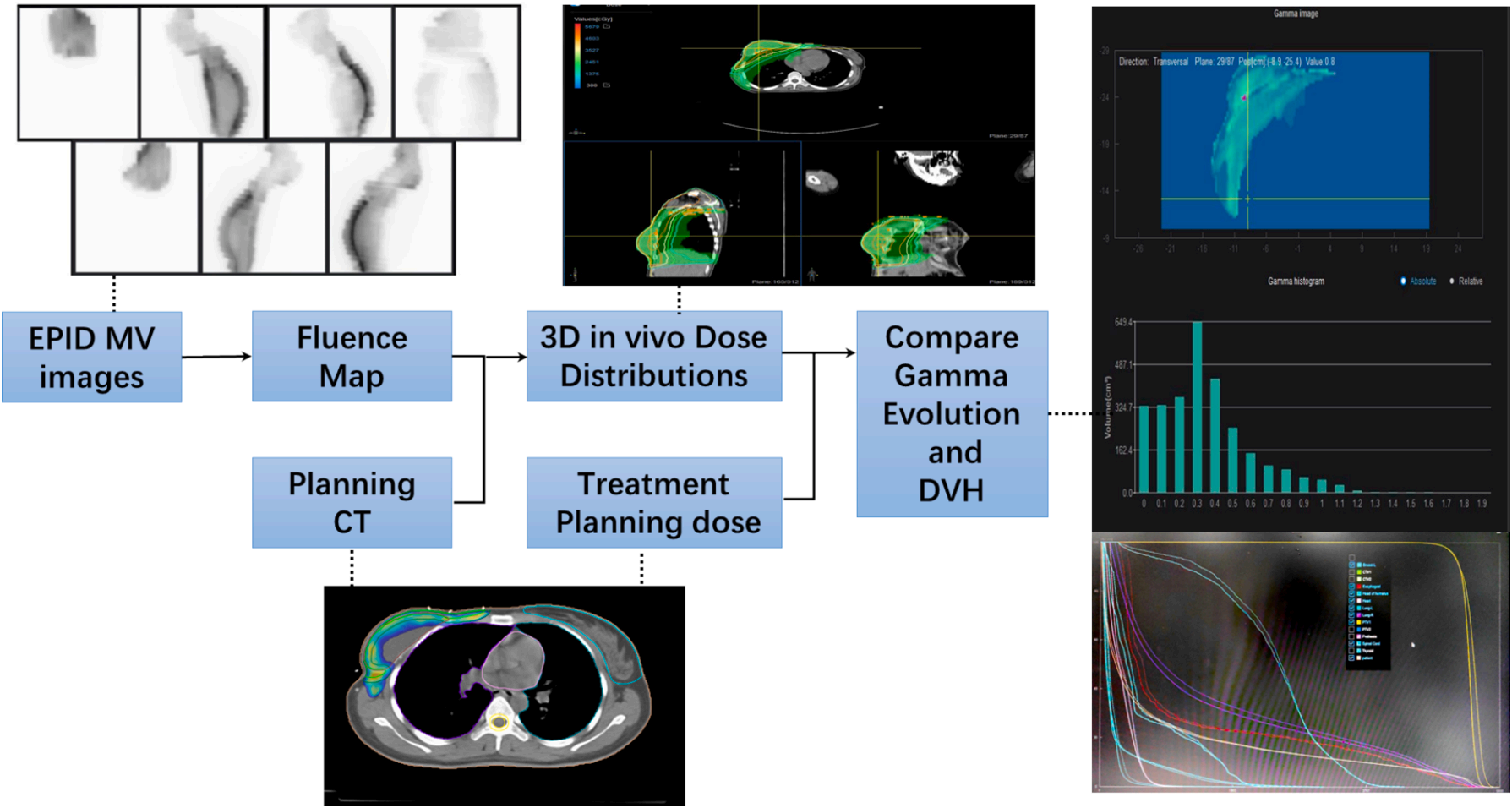 文献解读 | 基于EPID三维剂量重建技术在乳腺癌调强放疗在体剂量验证中的初步应用